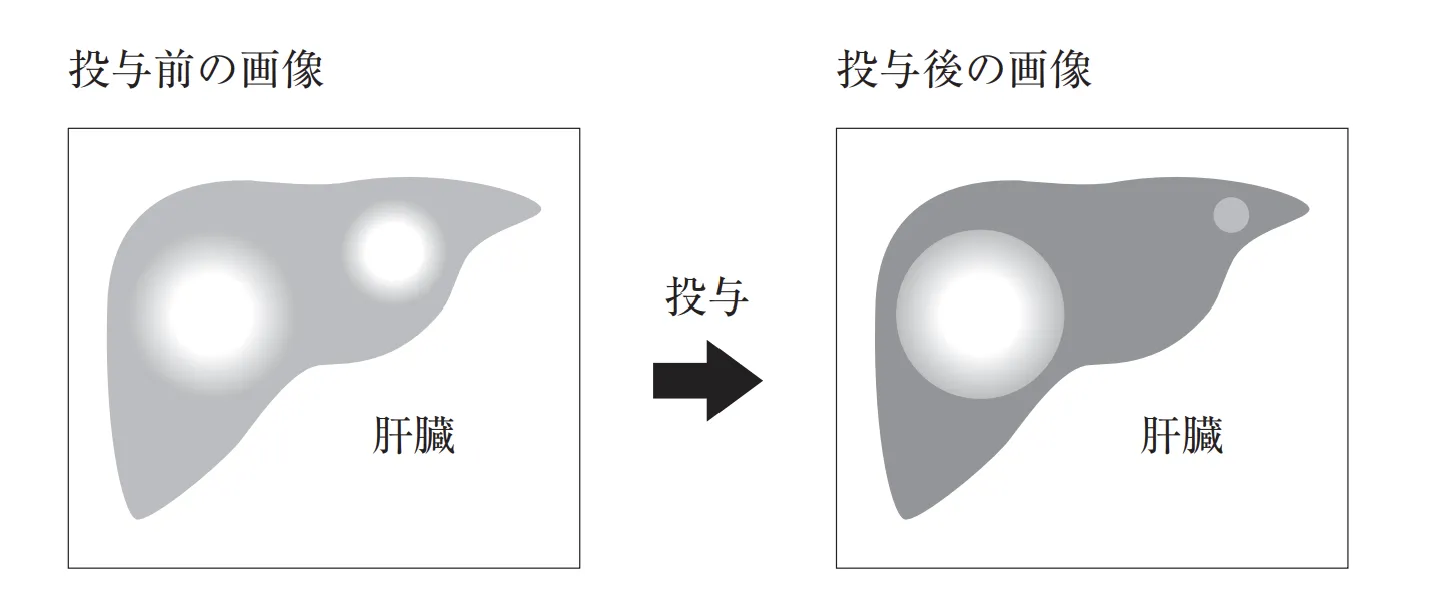 105回問200-201画像1